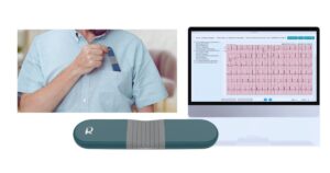 Read more about the article AI-Powered 24-Hour Heart Monitor: HHM1 Chest Lead Device Review